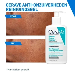 Discount Anti-Onzuiverheden Reinigingsgel Dermacare|Gezichtsreiniging