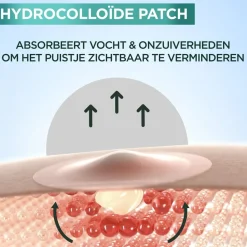 Sale Garnier PureActive Pimple Patches Pimple Patches