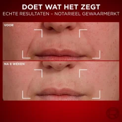 Hot L'Oréal Paris Revitalift Laser Anti-Rimpel Dagcrème Dagcreme