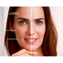 NIVEA Cellular Luminous630 Anti-Spot SPF50 Dagcrème Dagcreme