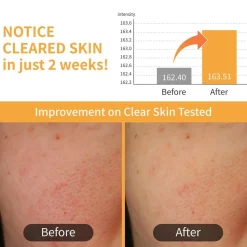 Best No.3 Radiance Glowing Jumbo Essence Pad Korean Skincare|Essence