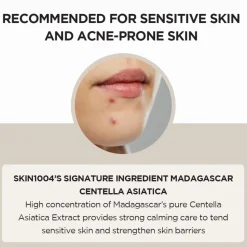 Hot Madagascar Centella Ampoule 55ml Korean Skincare|Ampoules