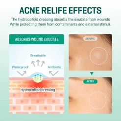 Sale SOME BY MI Clear Spot Patch Pimple Patches